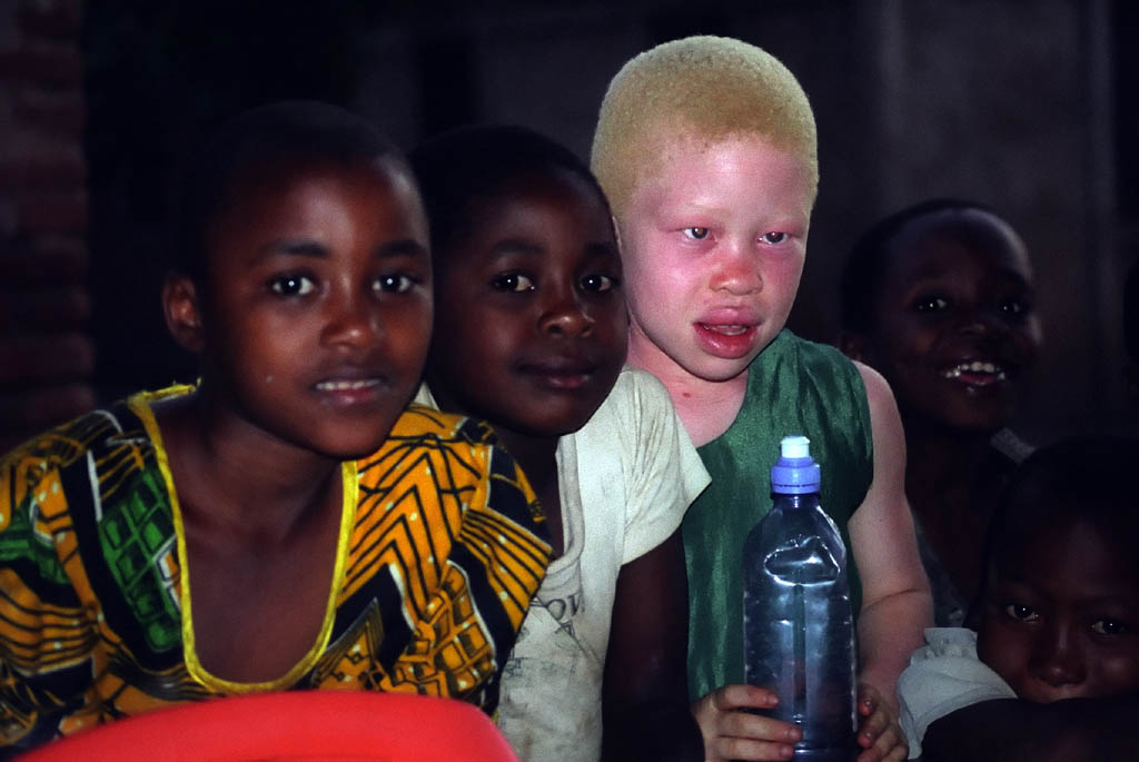 One of the two albino children in town. (Category:  Travel)