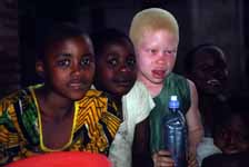 One of the two albino children in town. (Category:  Travel)