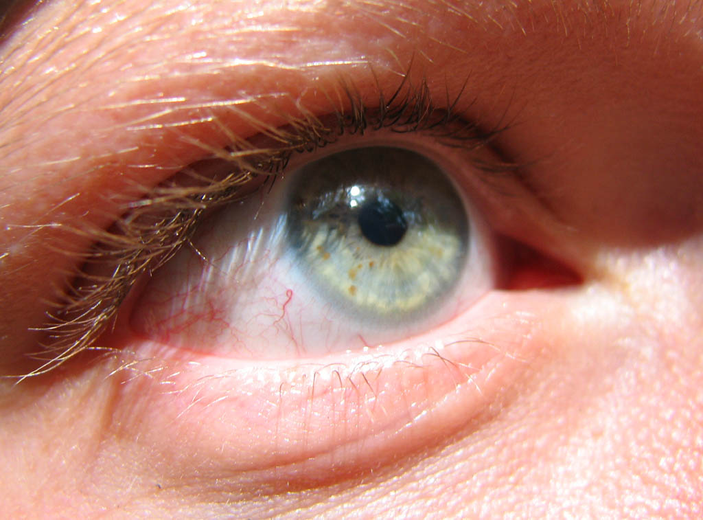 I like eyeball pictures. (Category:  Rock Climbing)