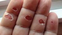 Do you wear gloves when you belay? (Category:  Resources)