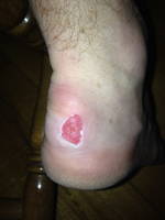 Unfortunately, this happened on both feet in the first mile of the first day. (Category:  Ice Climbing)