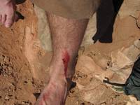 I did finally finish the climb.  And at some point got this scrape on my shin. (Category:  Rock Climbing)